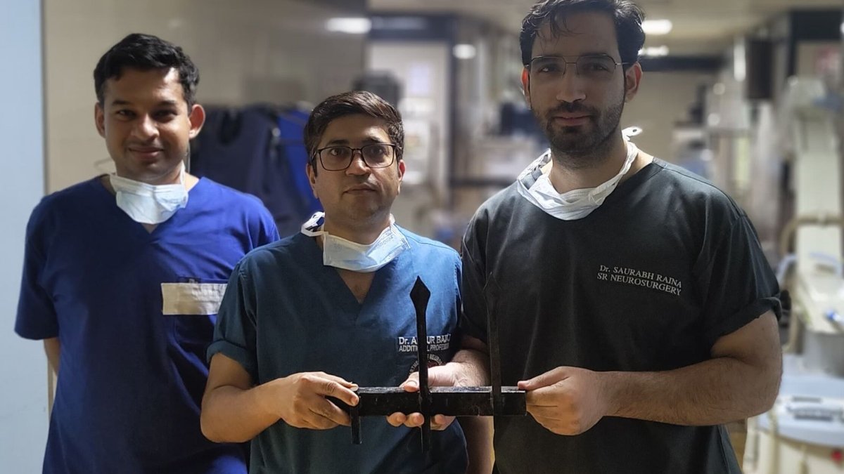 Read more about the article Lucknow Kgmu:लोहे की छड़ आर-पार, पर साहस और सेवा ने रचा चमत्कार… लखनऊ के डॉक्टरों ने बचाई मासूम की जान