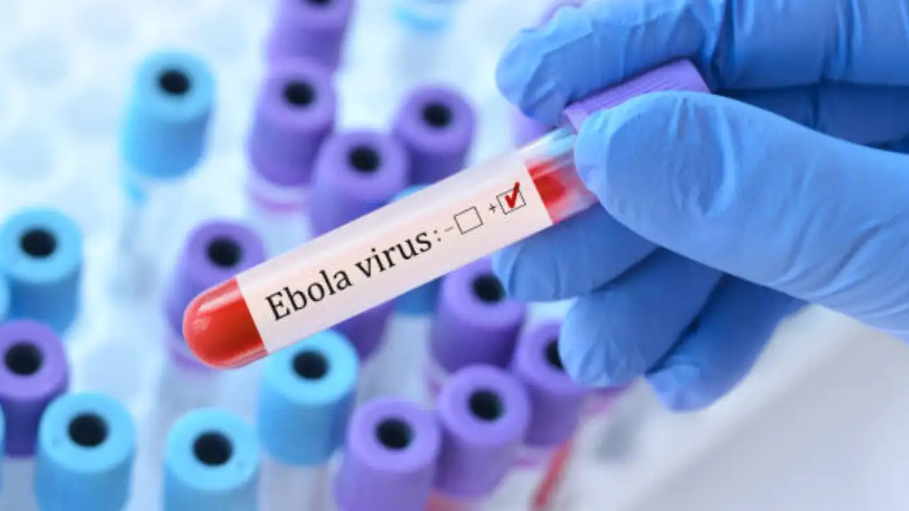Read more about the article Ebola Virus: इबोला वायरस का बढ़ता खतरा, अफ्रीका में हालात गंभीर; भारत सरकार भी सतर्क